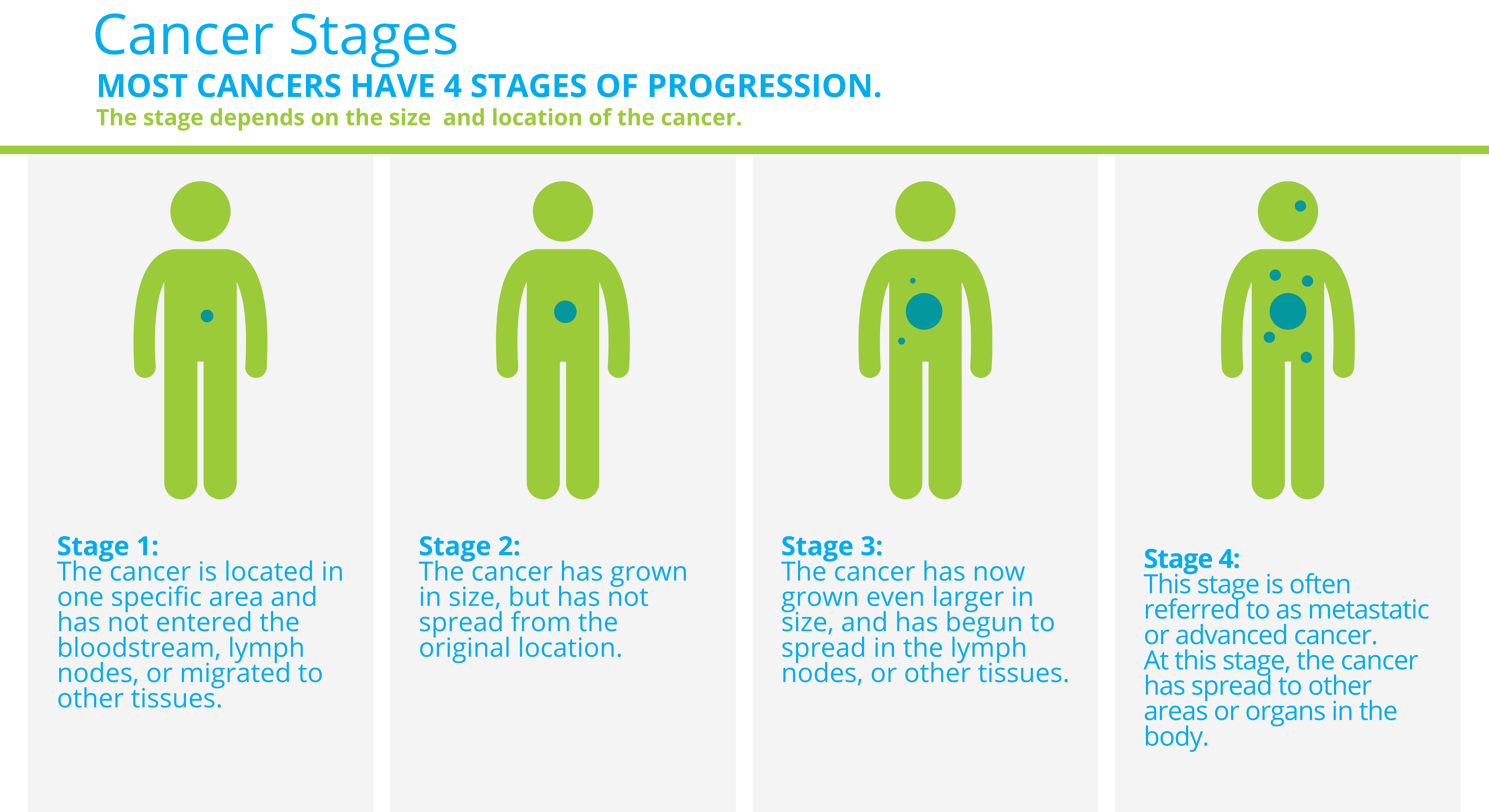 Cancer Stages Most cancers have four stages of progression. The stage depends on the size and location of the cancer. Stage l: The cancer is located in one specific area and has not entered the bloodstream, lymph nodes, or migrated to other tissues. Stage ll: The cancer has grown in size, but has not spread from the original location. Stage lll: The cancer has now grown even larger in size, and has begun to spread in the lymph nodes, or other tissues. Stage lV: This stage is often referred to as metastatic or advanced cancer. At this stage, the cancer has spread to other areas or organs in the body.